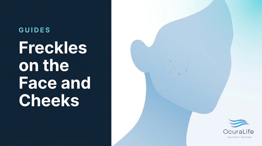 Editorial illustration: Freckles on the Face and Cheeks