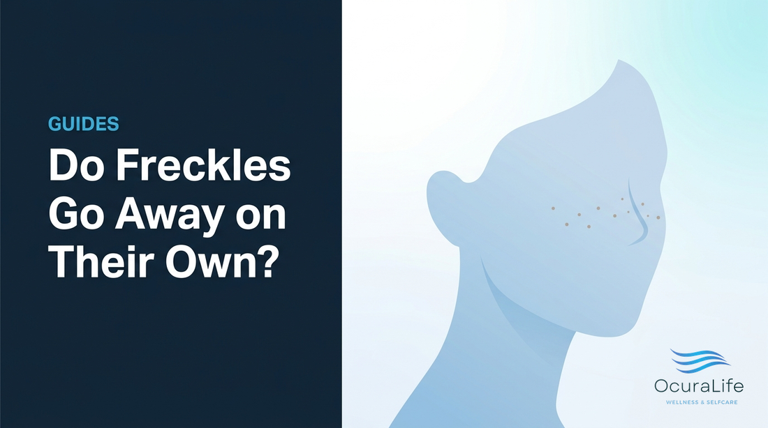 Editorial illustration: Do Freckles Go Away on Their Own?