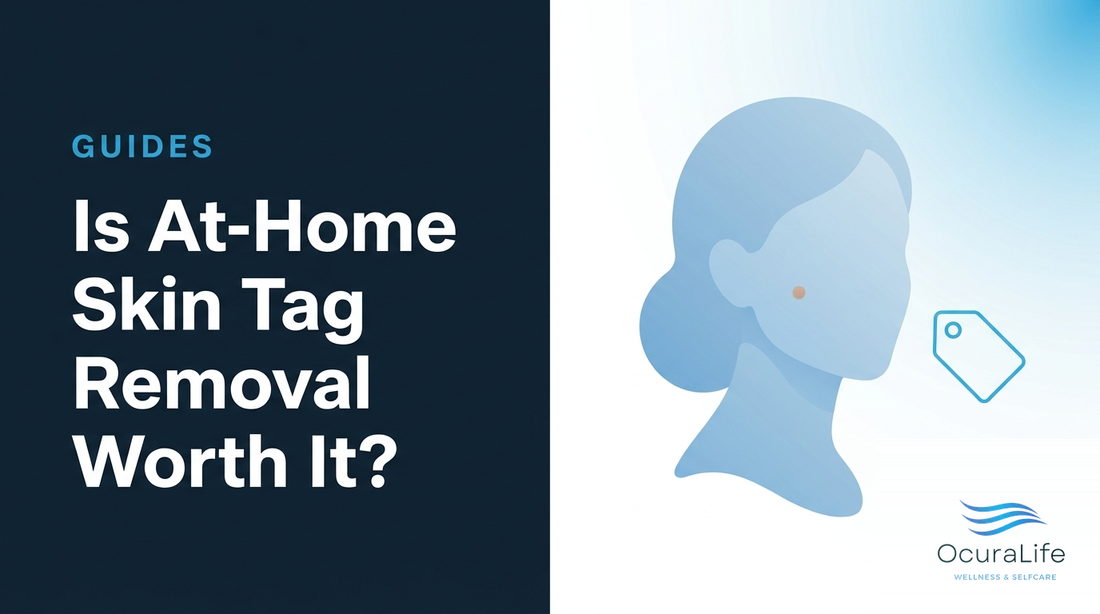 Is At-Home Skin Tag Removal Worth It?
