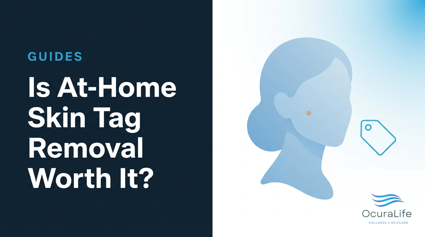 Is At-Home Skin Tag Removal Worth It?