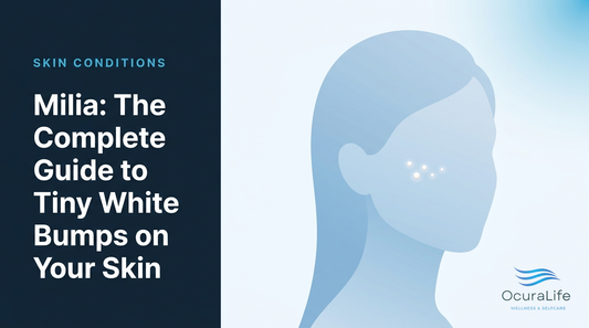 Milia: The Complete Guide to Tiny White Bumps on Your Skin