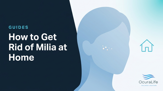 How to Get Rid of Milia at Home