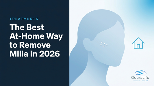 The Best At-Home Way to Remove Milia in 2026