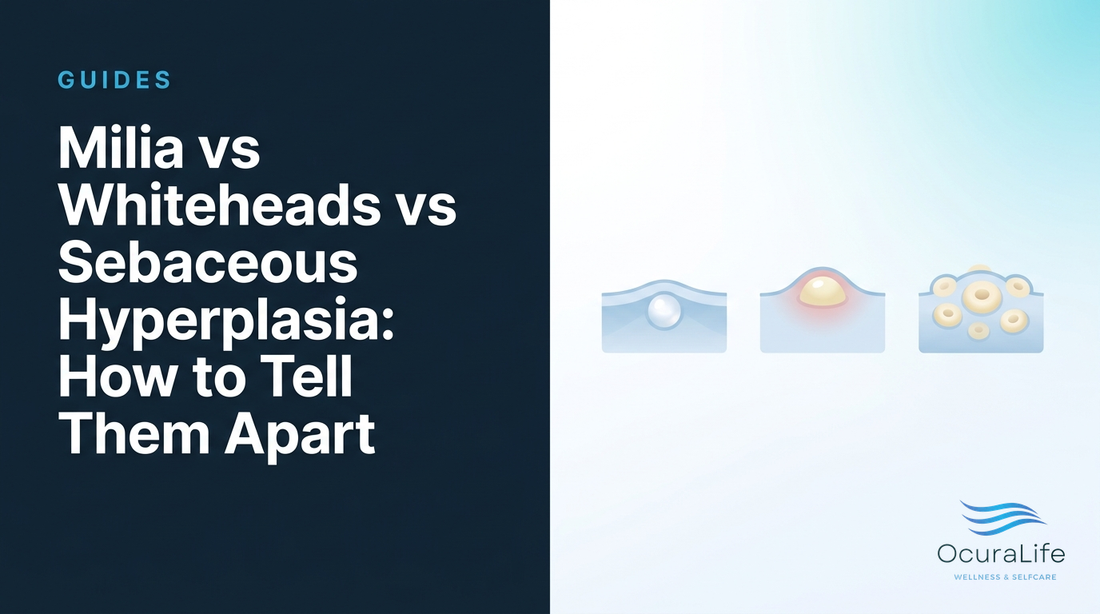 Milia vs Whiteheads vs Sebaceous Hyperplasia: How to Tell Them Apart
