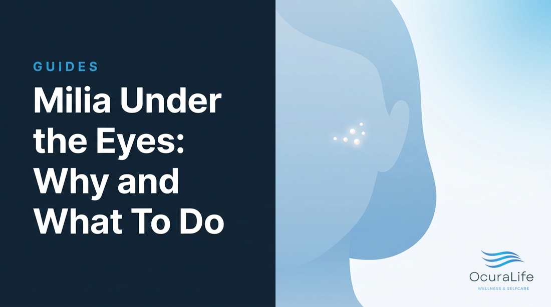 Milia Under the Eyes: Why and What To Do