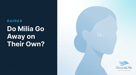 Do Milia Go Away on Their Own?