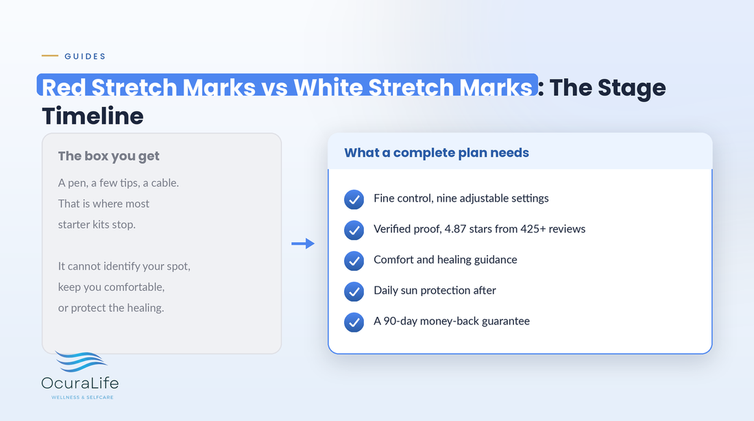 Red Stretch Marks vs White Stretch Marks: The Stage Timeline