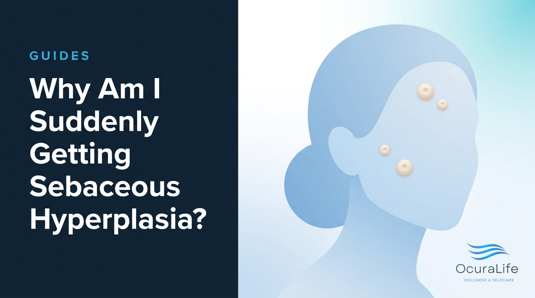 Why Am I Suddenly Getting Sebaceous Hyperplasia?