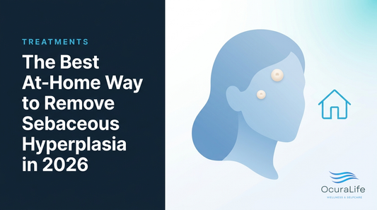 The Best At-Home Way to Remove Sebaceous Hyperplasia in 2026