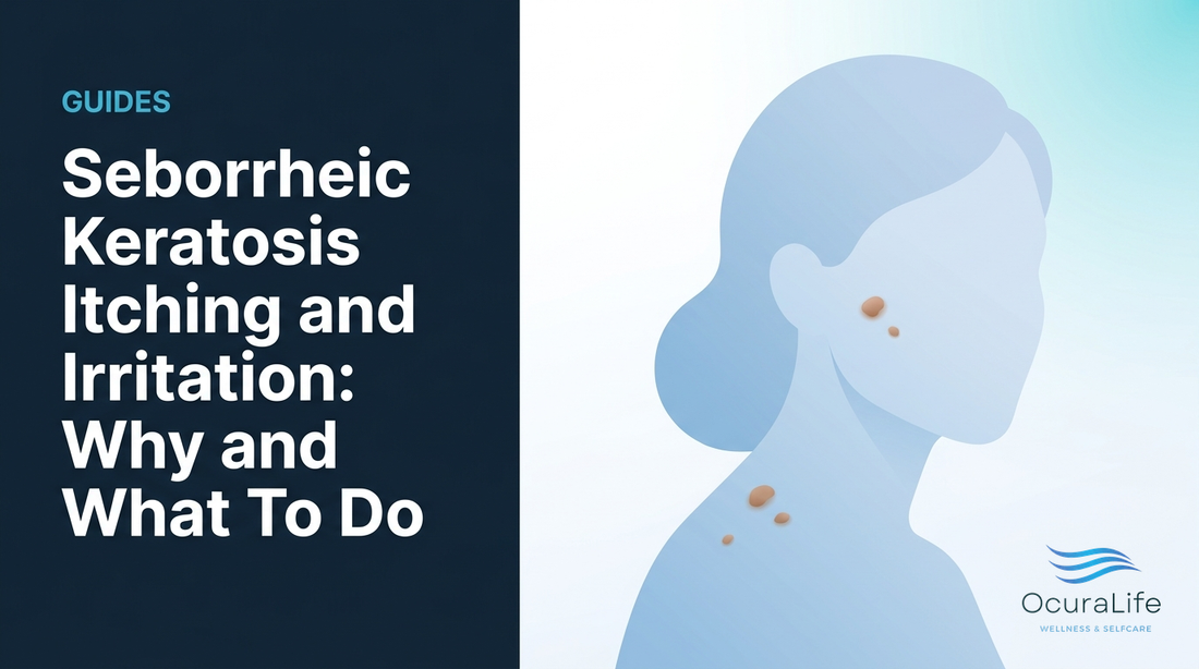 Editorial illustration: Seborrheic Keratosis Itching