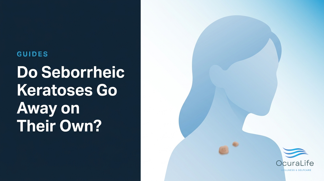 Editorial illustration: Do Seborrheic Keratoses Go Away on Their Own?