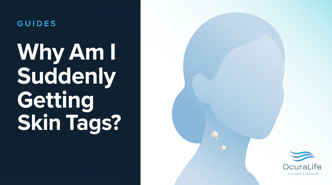 Why Am I Suddenly Getting Skin Tags?