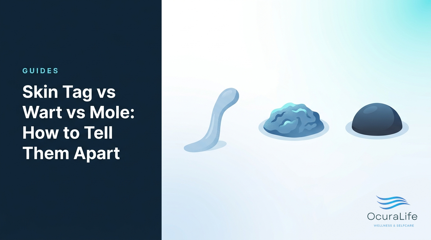 Skin Tag vs Wart vs Mole: How to Tell Them Apart