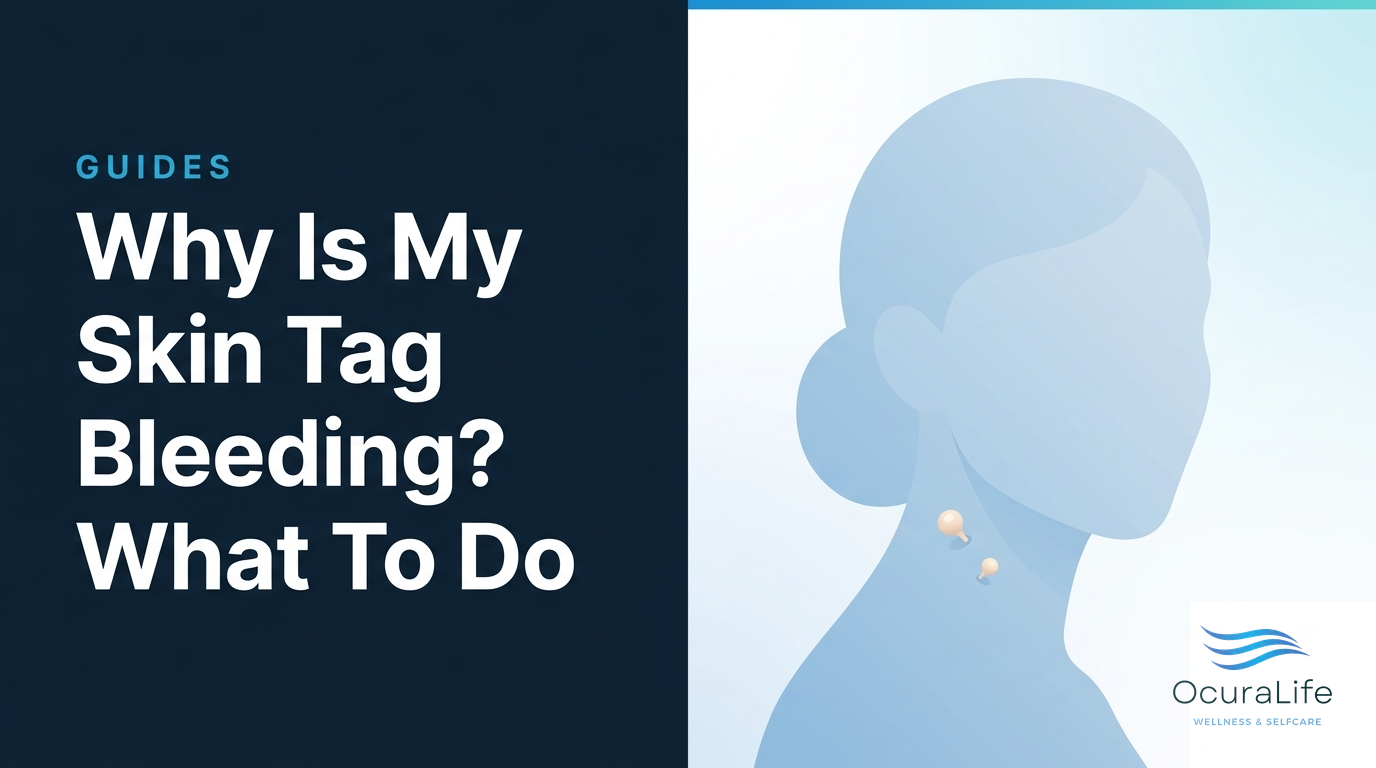 Why Is My Skin Tag Bleeding? What To Do