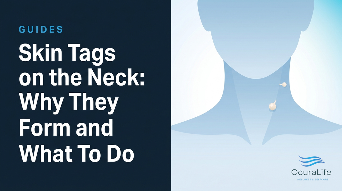 Skin Tags on the Neck: Why They Form and What To Do