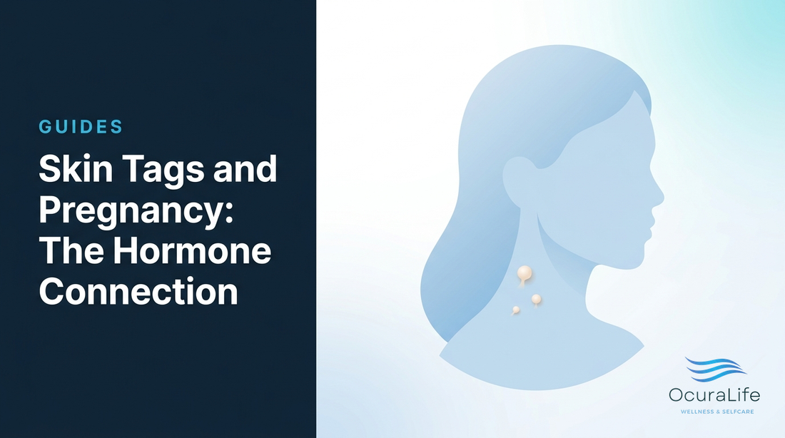 Skin Tags and Pregnancy: The Hormone Connection