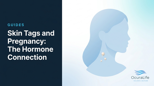 Skin Tags and Pregnancy: The Hormone Connection