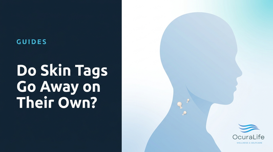Do Skin Tags Go Away on Their Own?