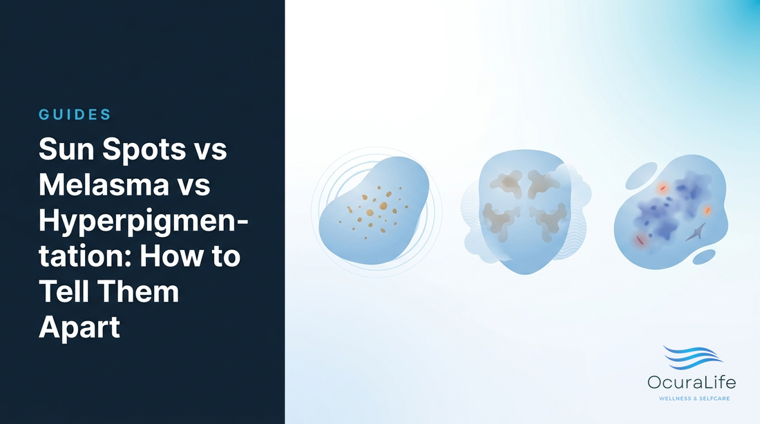 Editorial illustration: Sun Spots vs Melasma vs Hyperpigmentation