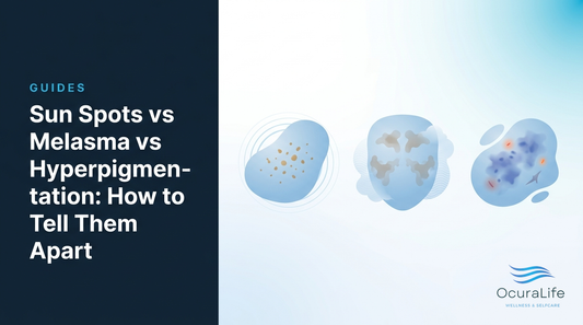 Editorial illustration: Sun Spots vs Melasma vs Hyperpigmentation