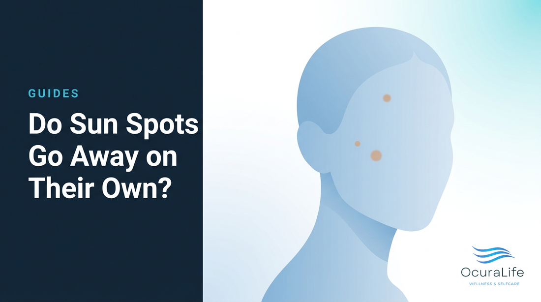 Editorial illustration: Do Sun Spots Go Away on Their Own?