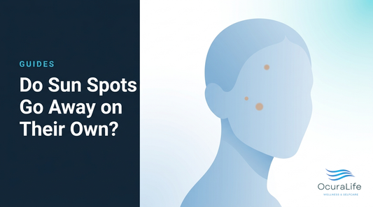 Editorial illustration: Do Sun Spots Go Away on Their Own?