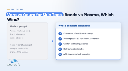 Vora vs Ocura for Skin Tags: Bands vs Plasma, Which Wins?
