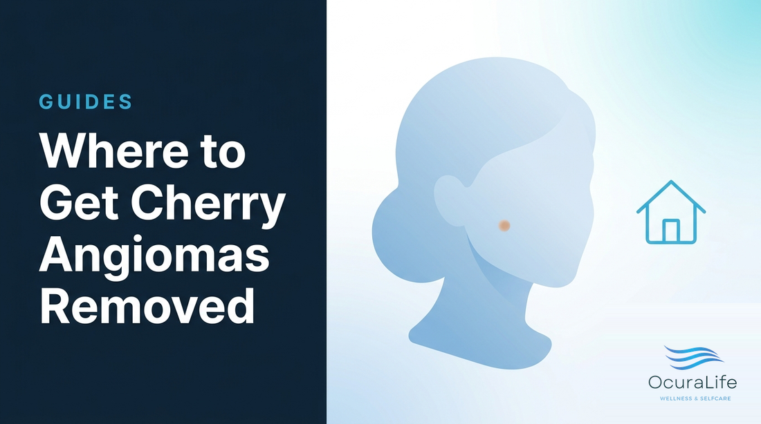 Where to Get Cherry Angiomas Removed