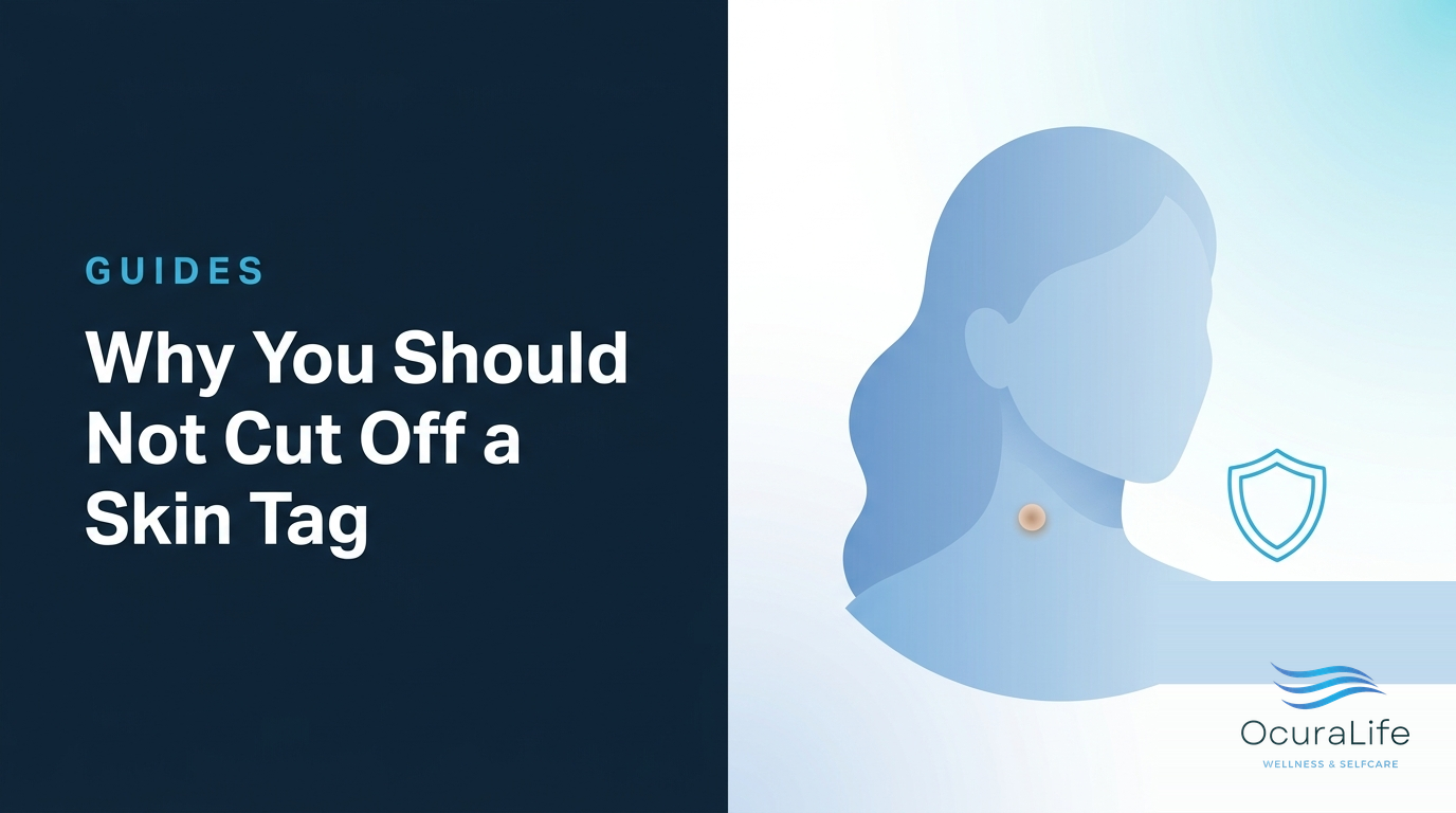 Why You Should Not Cut Off a Skin Tag