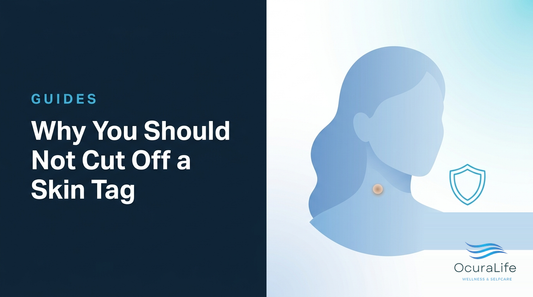 Why You Should Not Cut Off a Skin Tag