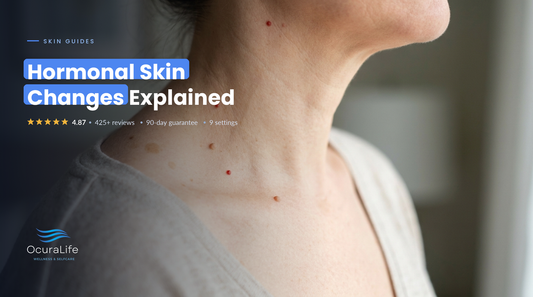 Cherry angiomas, skin tags and flat brown spots on a midlife woman's neck, common hormonal skin changes