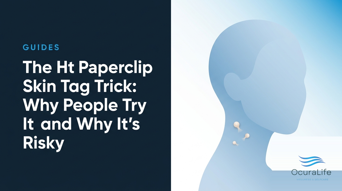 Hot Paperclip Skin Tag Removal Risks And Safer Options OcuraLife hot-paperclip-skin-tag-removal-risks-and-safer-options-ocuralife