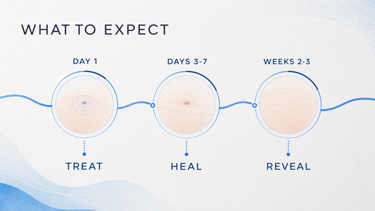 Plasma pen timeline infographic from Day 1 through Days 3 to 7 and Weeks 2 to 3