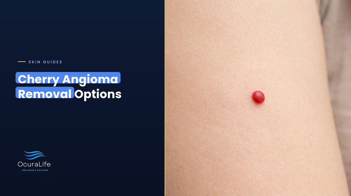 A small red cherry angioma on the upper arm, and the removal options that can clear it