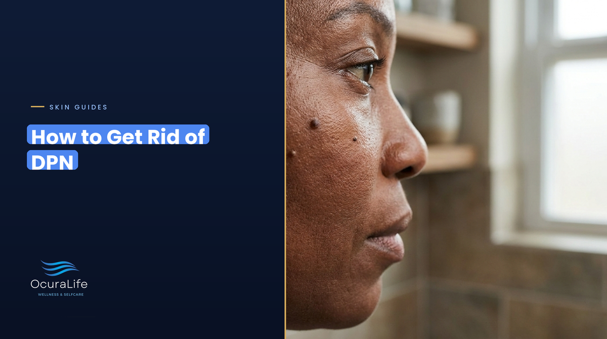 How to get rid of DPN: small dark raised bumps (dermatosis papulosa nigra) on the cheek of a woman with deep brown skin