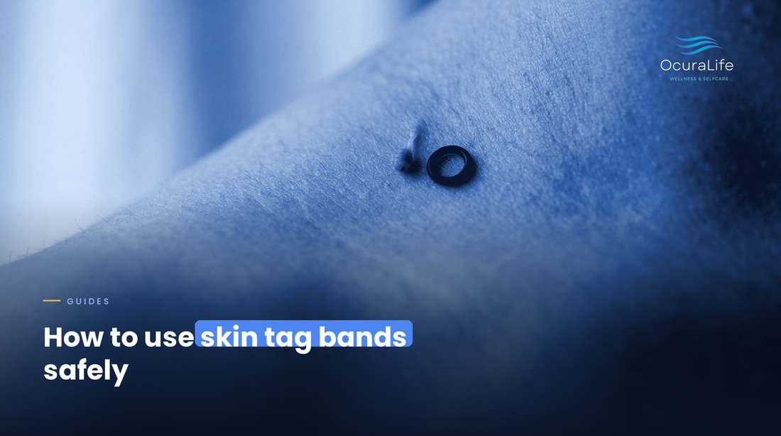 Skin-Tag Removal Bands: How to Use Them Safely (and Their Limits)