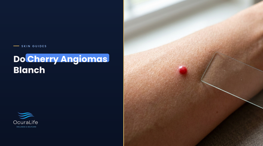 A small raised cherry-red dot on a forearm beside a clear glass slide used for the blanch test