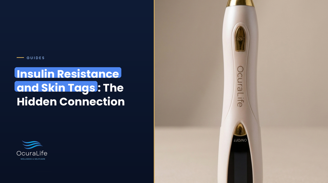 Insulin Resistance and Skin Tags: The Hidden Connection