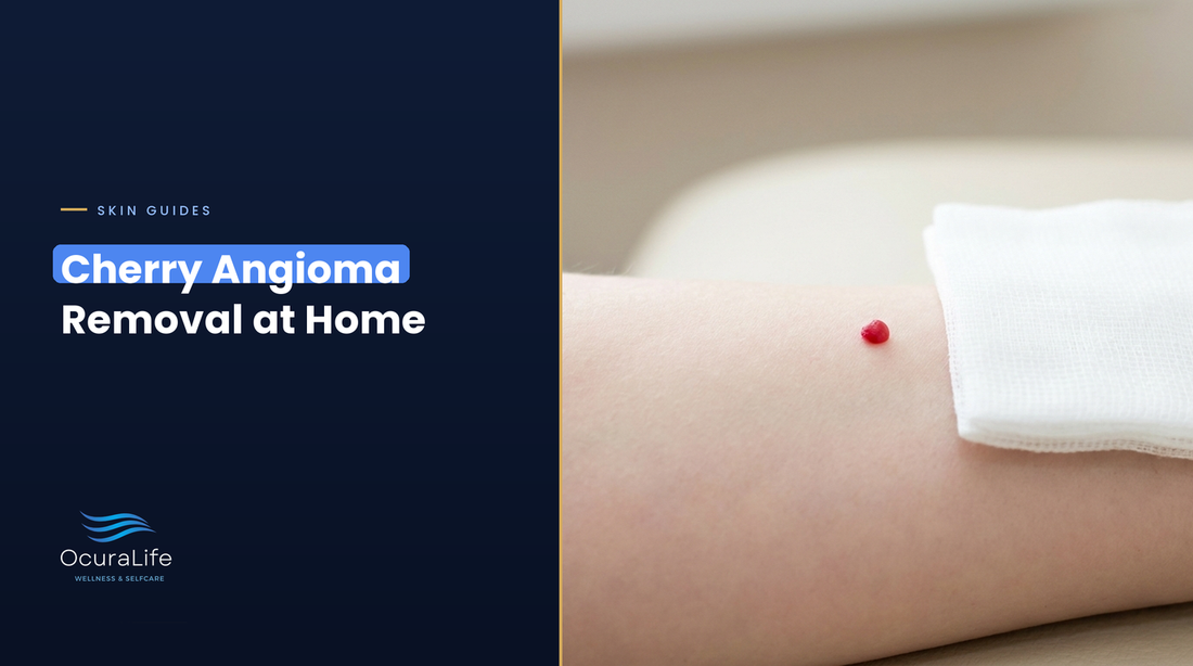 A small cherry angioma on the arm beside clean gauze, the safe way to handle a scratched spot