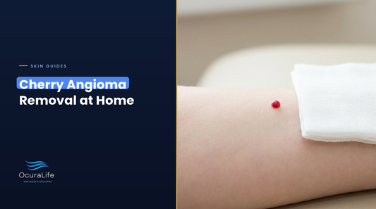A small cherry angioma on the arm beside clean gauze, the safe way to handle a scratched spot