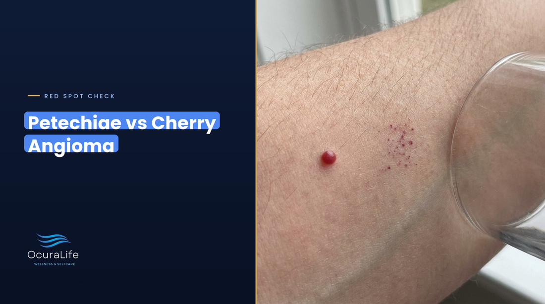 Petechiae vs cherry angioma: a raised ruby red dot beside a cluster of flat pinpoint red specks on the arm