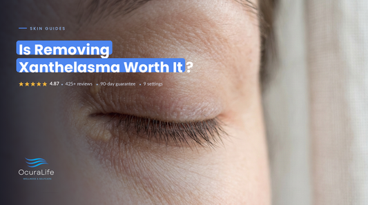Is Removing Xanthelasma Worth It?