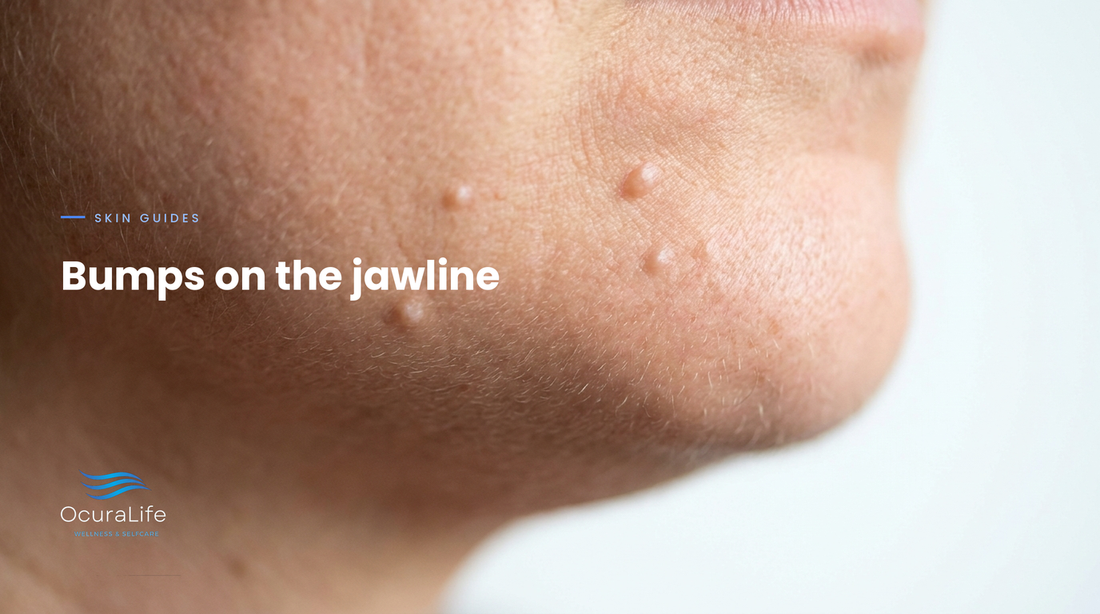 Close up of small flesh coloured raised bumps along an adult jawline and under the chin