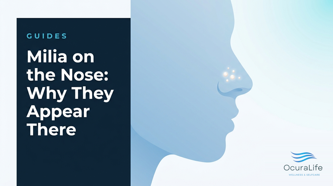 Milia on the Nose: Why They Appear There - OcuraLife