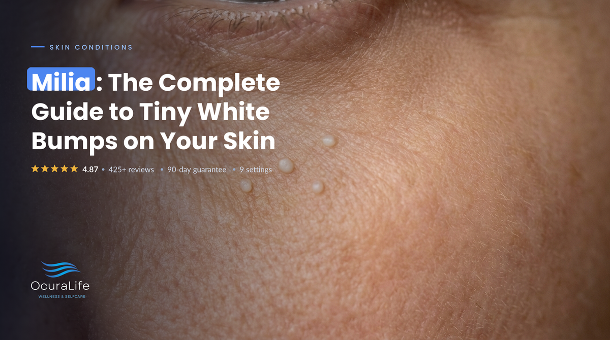 Milia: The Complete Guide to Tiny White Bumps on Your Skin