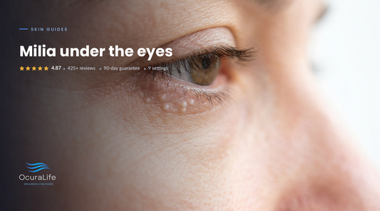 Close up of small pearly white milia bumps under a lower eyelid