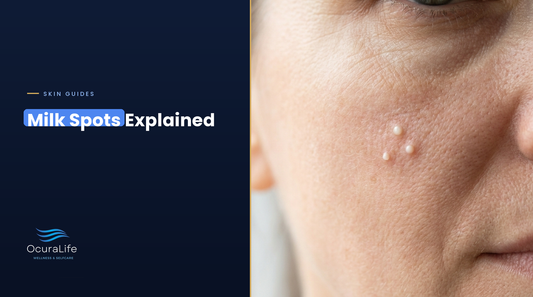 Tiny white milk spots (milia) on the cheek, milk spots explained