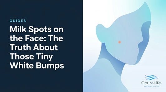 Milk Spots on the Face: The Truth About Those Tiny White Bumps