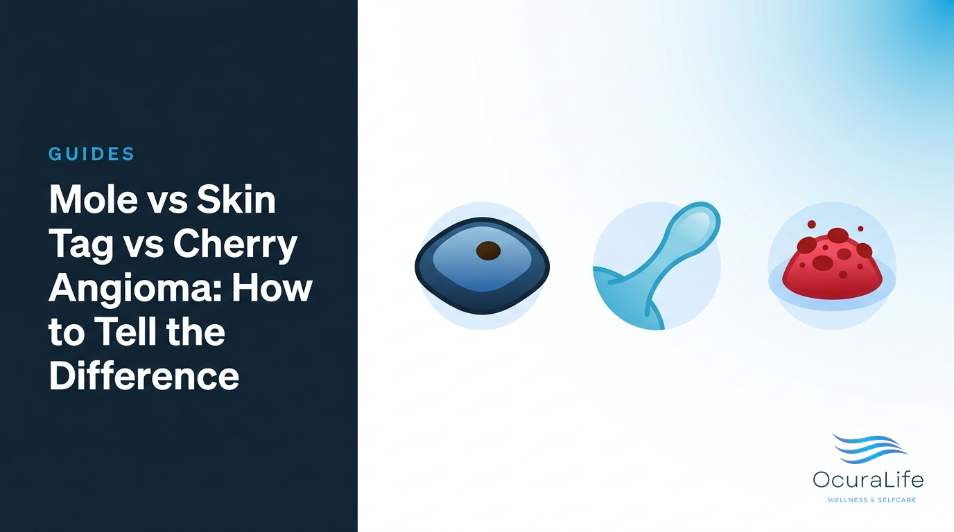 Editorial illustration: Mole vs Skin Tag vs Cherry Angioma: How to Tell the Difference