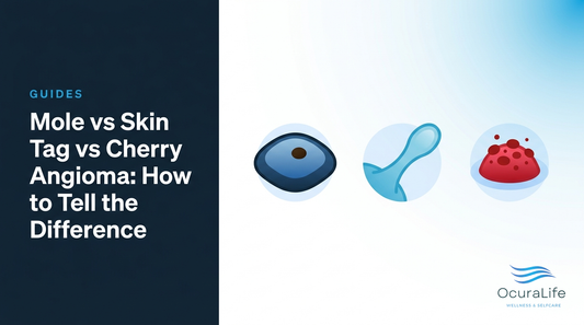 Editorial illustration: Mole vs Skin Tag vs Cherry Angioma: How to Tell the Difference